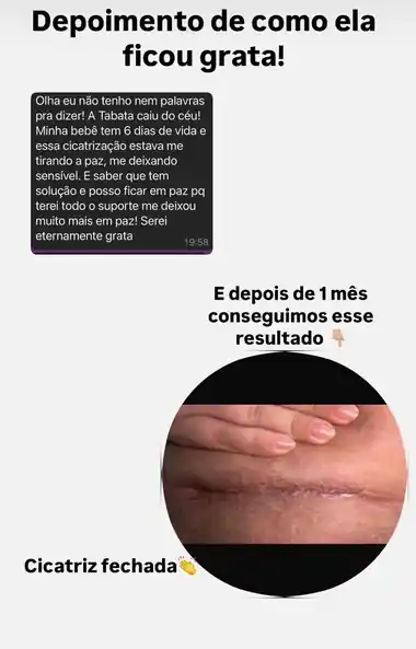 Mensagem de uma mãe agradecendo, e foto da cicatriz fechada depois de 1 mês